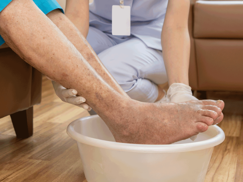 A female nurse is washing the feet of an old man for treatment preparation.